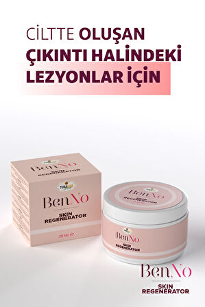 Benno Lezyon Kremi | Et Beni, Genital Siğil, Nasır Ve Siğil Bakım Kremi, 25 ml - Skin Regenerator