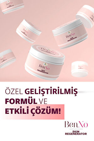 Benno Lezyon Kremi | Et Beni, Genital Siğil, Nasır Ve Siğil Bakım Kremi, 25 ml - Skin Regenerator