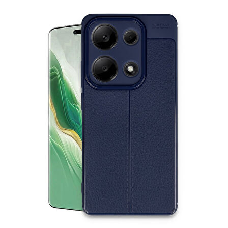 Xiaomi Redmi Note 13 Pro 4G Kılıf Focus Deri Desen Silikon Kapak