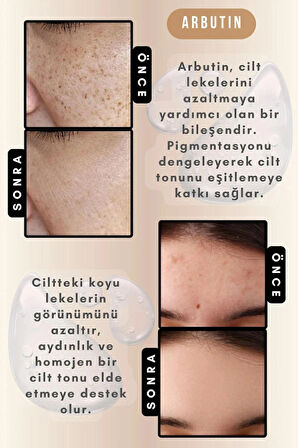 TO DO FIRST Cilt Tonu Eşitleyici ve Onarıcı Leke Serumu 30 ML