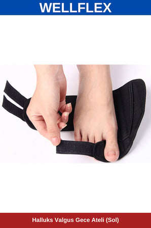 Halluks Valgus Gece Ateli Sol