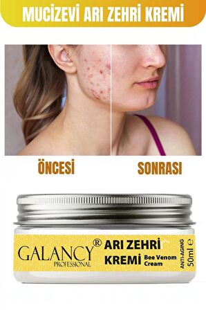 Sivilce Karşıtı Yüz Kremi - Arı Zehiri Içeren Besleyici Ve Onarıcı Vücut Ve Yüz Kremi 50ml sivilcekremi-arızehiri50ml