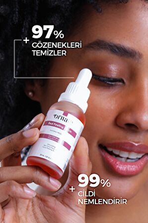 ORNATE Canlandırıcı Leke Karşıtı Yüz Peeling Serum