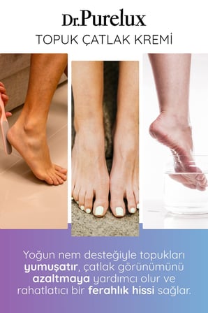 Topuk Çatlak Kremi – Shea Yağı & Hyaluronik Asit İçerikli Yoğun Nemlendirici Bakım Kremi 100 ml