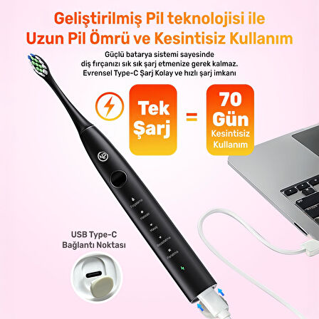 NPO Nicefeel X610-Z Dakikada 40000 Titreşim, Şarjlı Sonic Profesyonel Diş Fırçası-Siyah