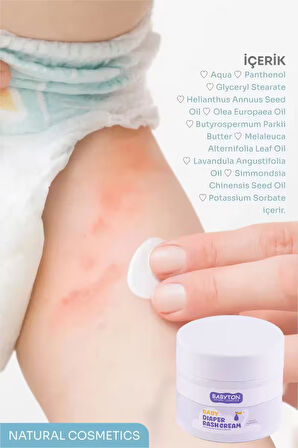 Babyton Doğal Pişik Kremi 50 ml