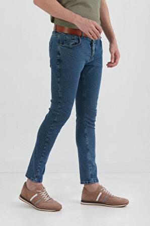 Fermuarlı Skinny Jean Pantolon