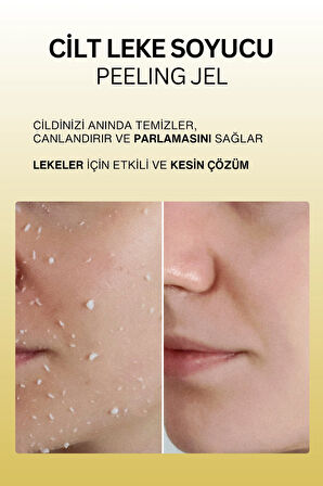 Dr. Wsay Cilt Leke Soyucu Peeling Jel
