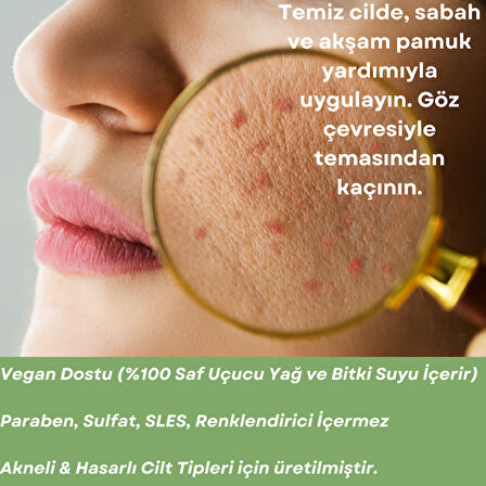 Skin Care Toner - Akneli Ciltler İçin Cilt Bakım Suyu