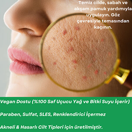 ANTI-ACNE TONER Çay Ağacı ve Palmarosa Özlü Cilt Bakım Suyu