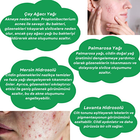 ANTI-ACNE TONER Çay Ağacı ve Palmarosa Özlü Cilt Bakım Suyu