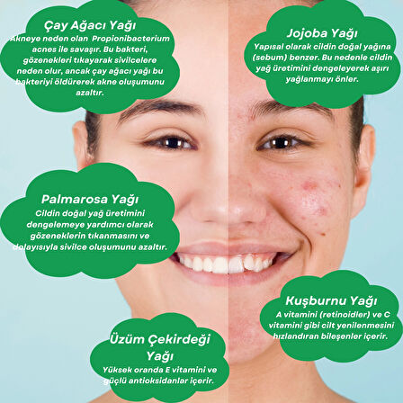 ANTI-ACNE SERUM Akne Karşıtı Yüz Serumu