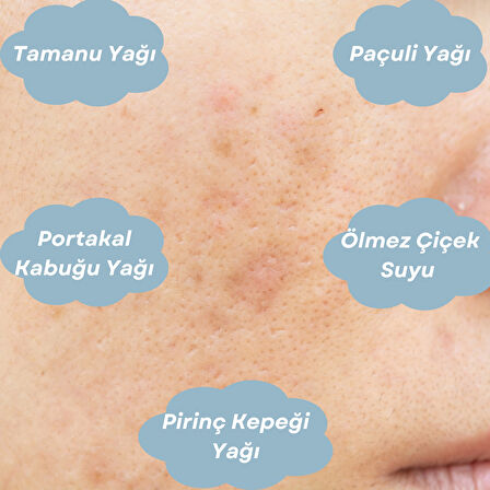 ANTI-BLEMISH SERUM Leke Giderici Cilt Bakım Serumu