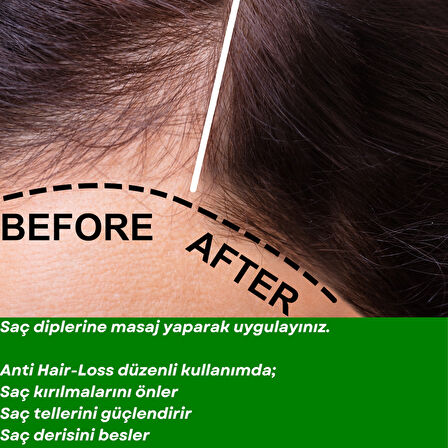 ANTI HAIR LOSS- 10 FORCES Saç Dökülmelerine Karşı 10 Aromatik Yağ Karışımı