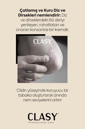El, Diz Ve Dirsek Bakım Kremi - Çatlamış, Kurumuş, Koyulaşmış Sert Deriye Karşı