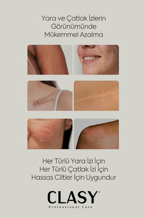 Yara Ve Çatlak Izleri Görünümünü Azaltıcı Ve Mükemmel Önleyici Krem (SCARS & STRETCH MARKS CREAM)