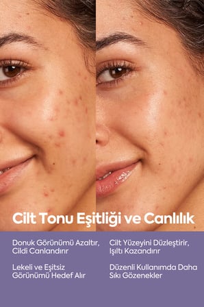 Salisik Asit, Aha Bha Cilt Serumu, Ölü Hücrelerden Arındırma, Lekeleri Azaltma, Pürüzsüz Cilt