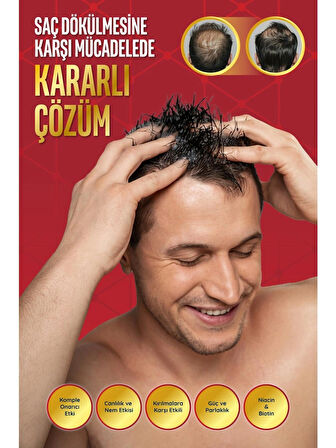 Storm Vıtals Storm Derma Stımulating Shampoo Niacın - Biotın Dökülme Karşıtı 400 ml