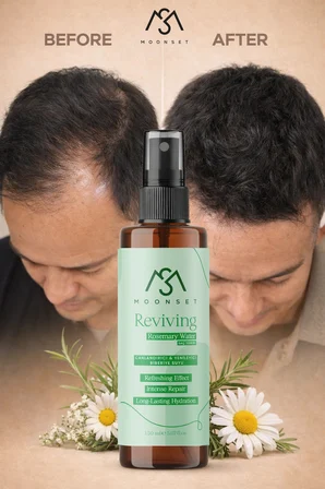 moonset Biberiye Suyu Dökülme Karşıtı ve Hızlı Saç Uzatma Etkili Saç Toniği 150 ml