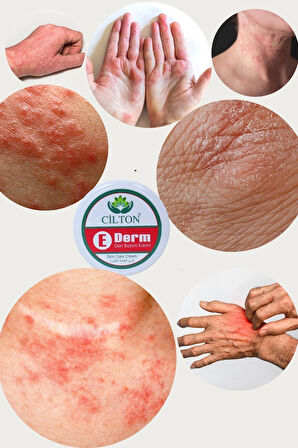 CİLTON E DERM 50 ML 