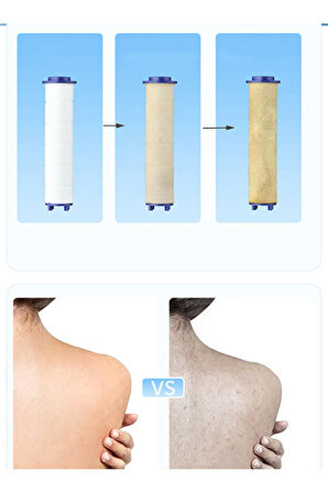 Mucit Home Beyaz Spa Modlu Filtreli Duş Başlığı 5 Fonksiyonlu Duş Fiskiyesi