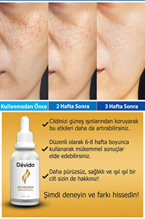 Devida Yoğun Leke Karşıtı Aydınlatıcı Canlandırıcı Anti-Tache Premium Serum