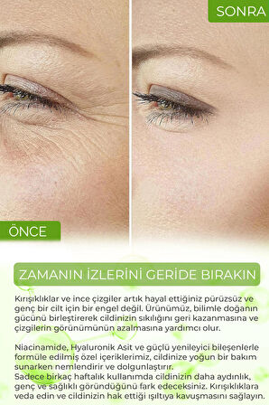 Devida Siyah Nokta Ve Gözenek Sıkılaştırıcı Serum Reducteur De Pores