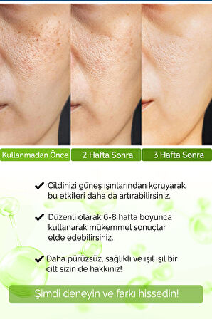 Devida Siyah Nokta Ve Gözenek Sıkılaştırıcı Serum Reducteur De Pores