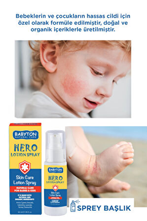 Anlık Yatıştırıcı Hero Losyon Sprey