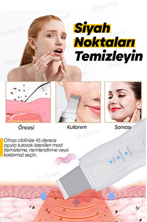 Sheland Ultrasonik Yüz Spatulası Siyah Nokta Giderici - Garantili.