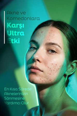 Aida Jia Akne Komedon Siyah Nokta Karşıtı Serum Salisilik Asit Glikolik Asit 30 ML