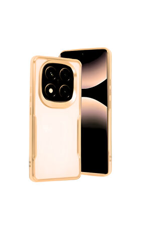 Xiaomi Redmi Note 14 Pro 4G Mat Lazer Telefon Kılıfı  Gold