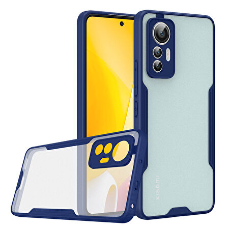 Xiaomi Mi 12 Lite Kılıf Parfe Kenarları Pastel Renk Silikon Kılıf