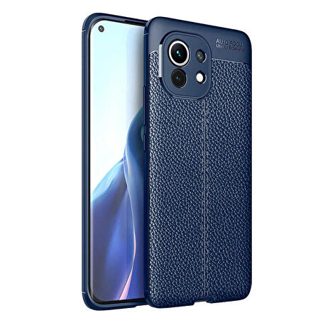 Xiaomi Mi 11 Kılıf Zore Niss Deri Desenl Silikon Kılıf