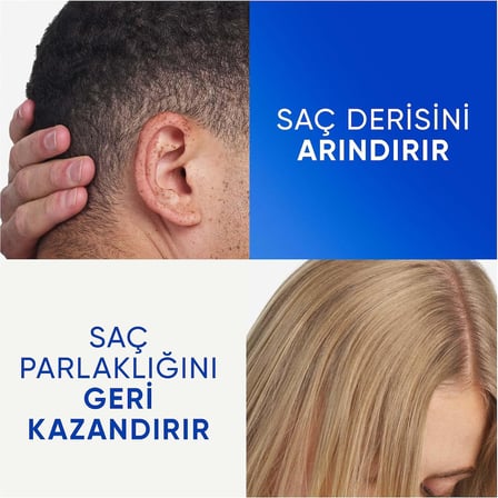 Arindirma Ve Parlaklik Kepege Karsi Etkili Sampuan 330Ml