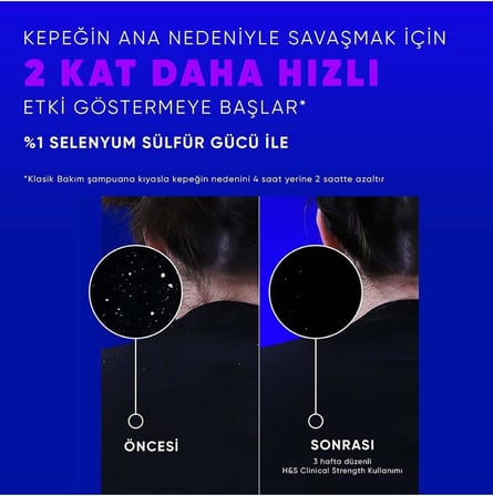 Clinical Strength Advanced Oil Control Yağ Dengeleyici Şampuan 400 Ml X2 Adet