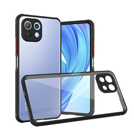 Xiaomi Mi 11 Lite Kılıf Kenar Renkli Sararmaz Şeffaf Kapak