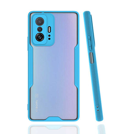 Xiaomi Mi 11T 5G Kılıf Kenar Renkli Kamera Korumalı Mat Kapak