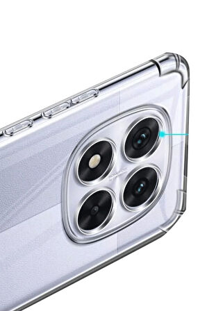Xiaomi Redmi Note 14 Pro 5G Kılıf Şeffaf Silikon Hibrit Case Kapak