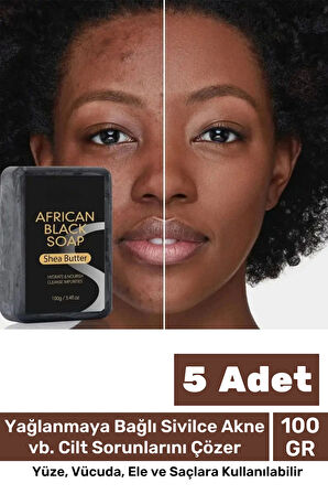 100% Doğal Güzel Kokulu El Yüz Saç Vücut Cilt Onaran Kolajen Etkili Afrika Bitkisel Sabun 5 Adet