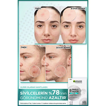 Pimple Patch 22'li Sivilce Bandı / Hidrokolloid Bant