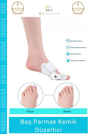 #ParmakDüzeltici Ortopedik Hallux Valgus Gece Gündüz Ateli Ayak Sağlığı Parmak Kemik Düzeltici 1 - Adet