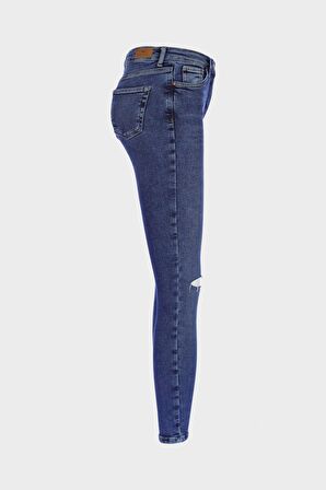 Judy Koyu Mavi Yüksek Bel Dizi Yırtıklı Skinny Jean Pantolon C 4521-195