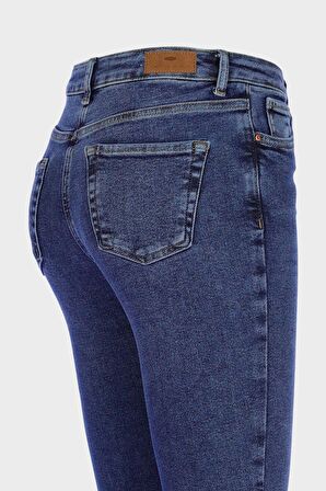 Judy Koyu Mavi Yüksek Bel Dizi Yırtıklı Skinny Jean Pantolon C 4521-195