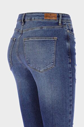 Judy Orta Mavi Yüksek Bel Yıpratmalı Fermuarlı Skinny Fit Jean Pantolon C 4521-226