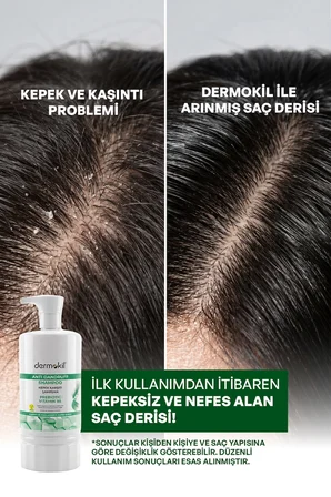 Dermokil Kepek Karşıtı Saç Bakım Seti