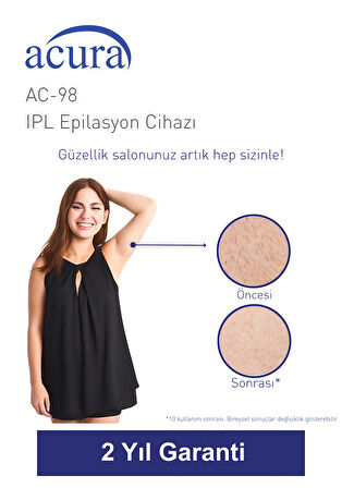 AC-98 Ultra Hızlı, Sınırsız Atışlı Buz Lazer IPL Lazer Epilasyon Cihazı