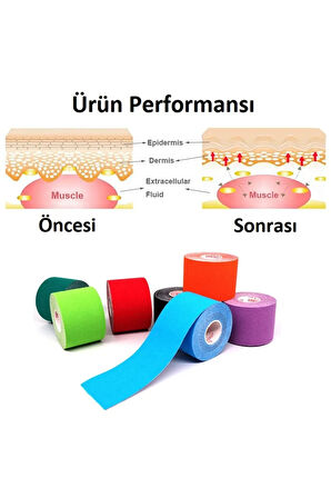 Ac-150 Yüz & Vücut Uyumlu Hipoalerjenik Kinesyo Tape Ağrı Bandı 5m X 5cm Sarı Renk 1 Beden