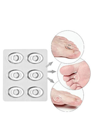 Silikon Nasır Koruyucu Yastık