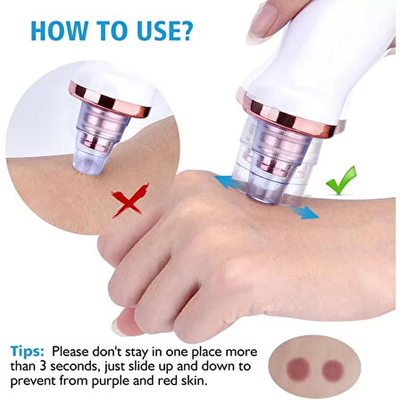 Şarjlı Siyah Nokta Temizleme Cihazı 5 Başlıklı 